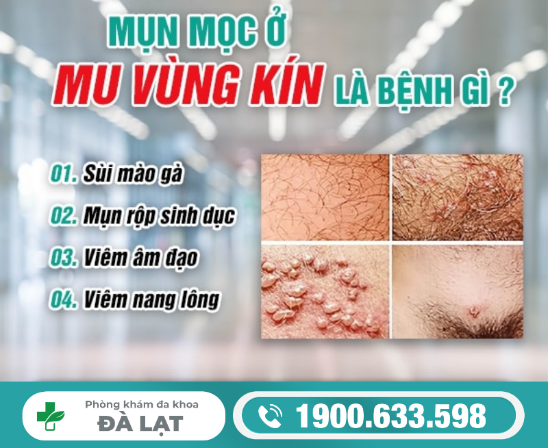 Hình ảnh minh họa